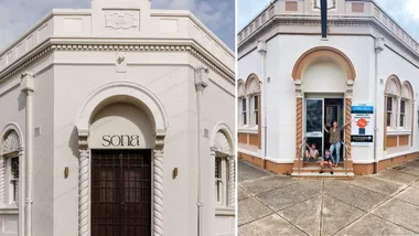 Sona Molong before and After images.